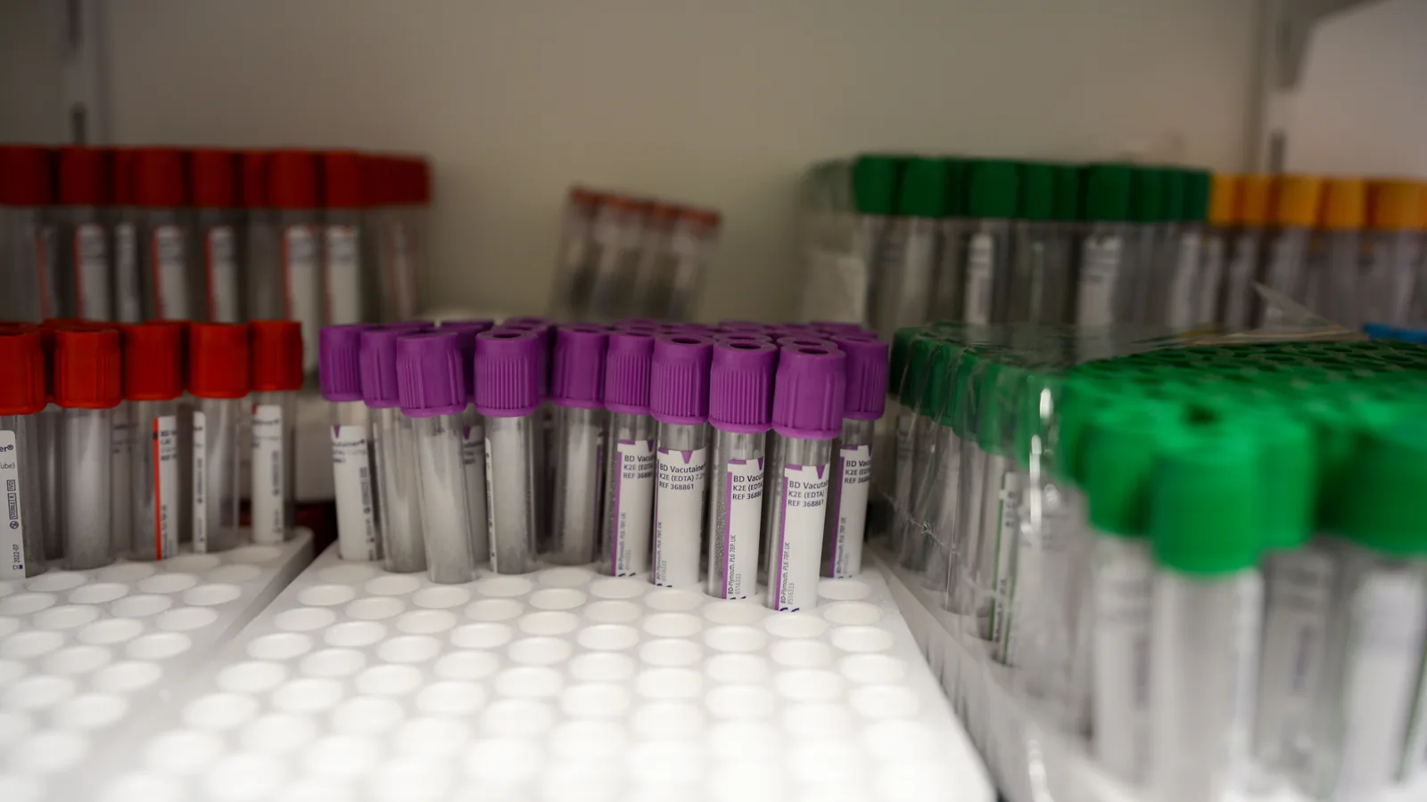 Blood collection tubes with red, purple and green caps in a laboratory